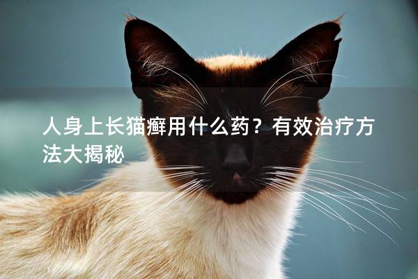 人身上长猫癣用什么药？有效治疗方法大揭秘